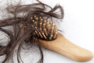 Что делать, если выпадают волосы на голове у женщин