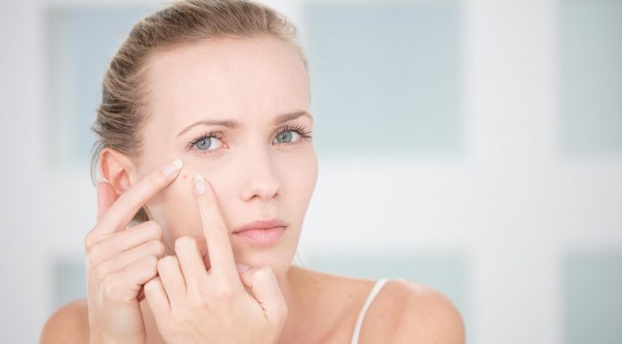 Причина возникновения прыщей Причина возникновения прыщей