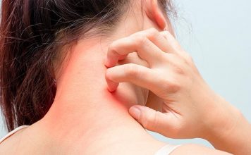 Кожные заболевания – проблематика для человека Кожные заболевания – проблематика для человека