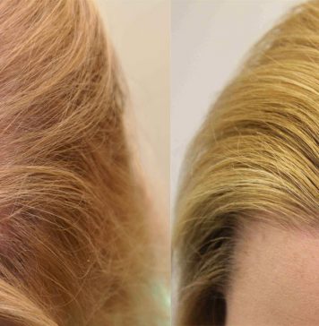 Препараты, вызывающие алопецию или изменяющие цвет волос Препараты, вызывающие алопецию или изменяющие цвет волос