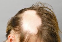 Что делать если волосы на голове начинают выпадать? Что делать если волосы на голове начинают выпадать?