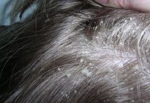 7 основных болезней волос и кожи головы. Причины и лечение 7 основных болезней волос и кожи головы. Причины и лечение