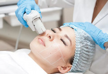 SMAS лифтинг SMAS лифтинг