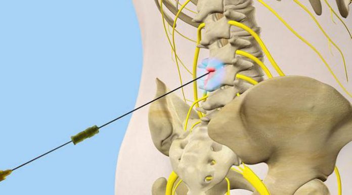 Блокада крестцового отдела позвоночника Блокада крестцового отдела позвоночника