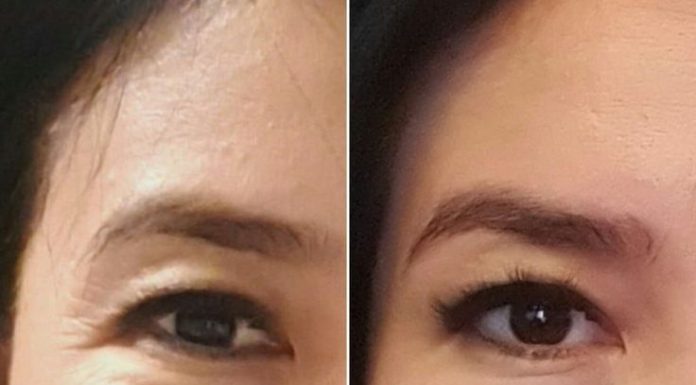 Инновационное средство по омоложению — Rejuven8 Инновационное средство по омоложению - Rejuven8