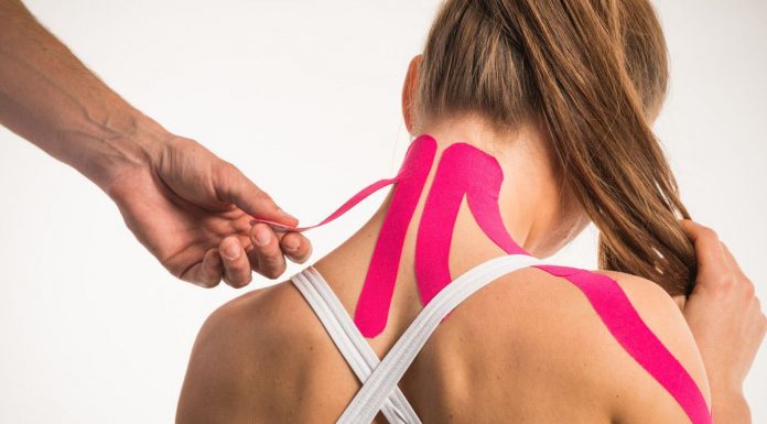 Что такое кинезиотейпирование Что такое кинезиотейпирование