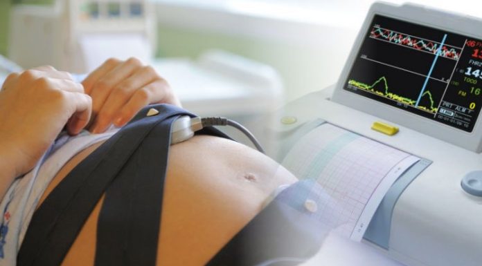 Особенности кардиотокографии плода Особенности кардиотокографии плода