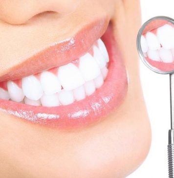 Как отбелить зубы в домашних условиях?