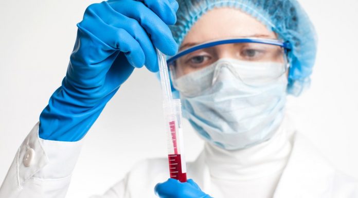 Анализ ANA — какие заболевания выявляет?