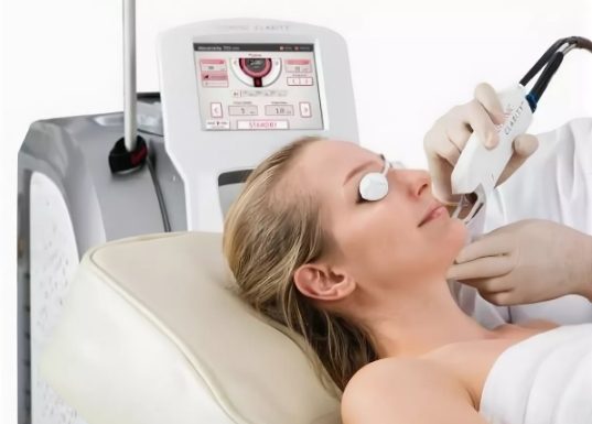 Эпиляция александритовым лазером: принцип действия и преимущества.