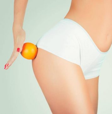 Как уменьшить целлюлит?